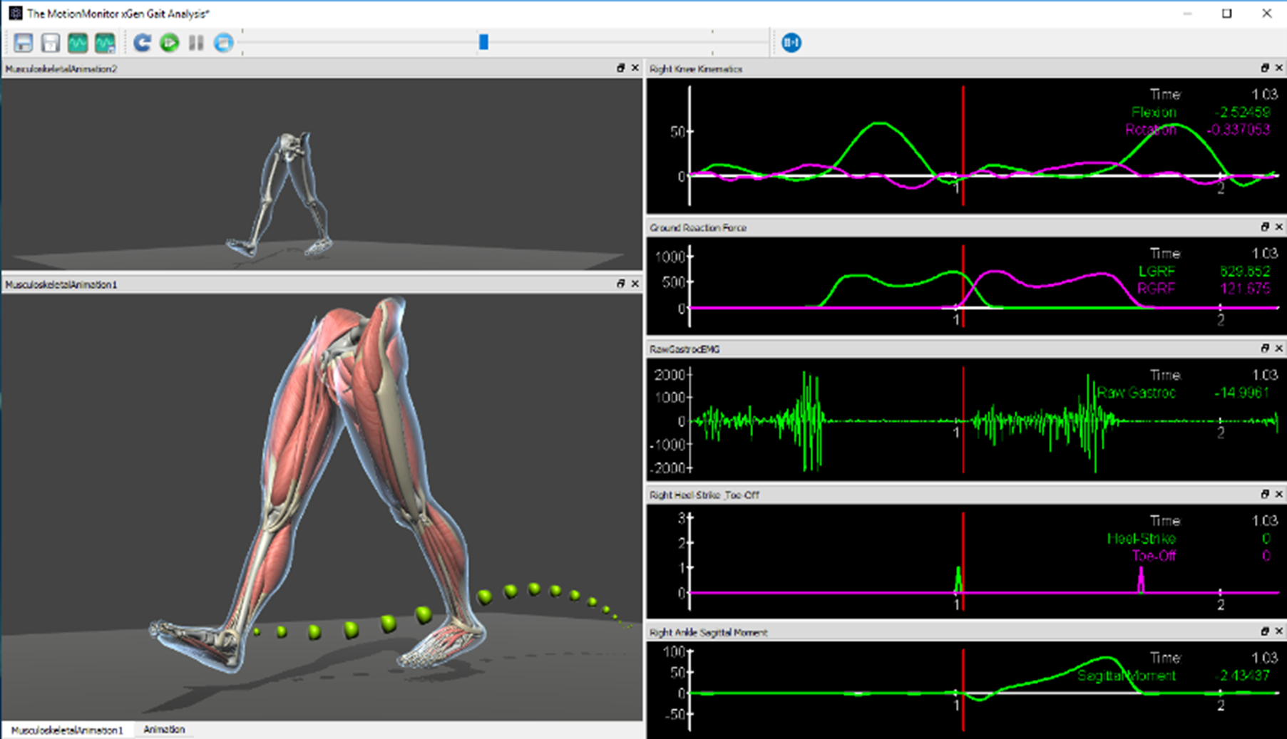 The MotionMonitor xGen running the Gait Analysis application